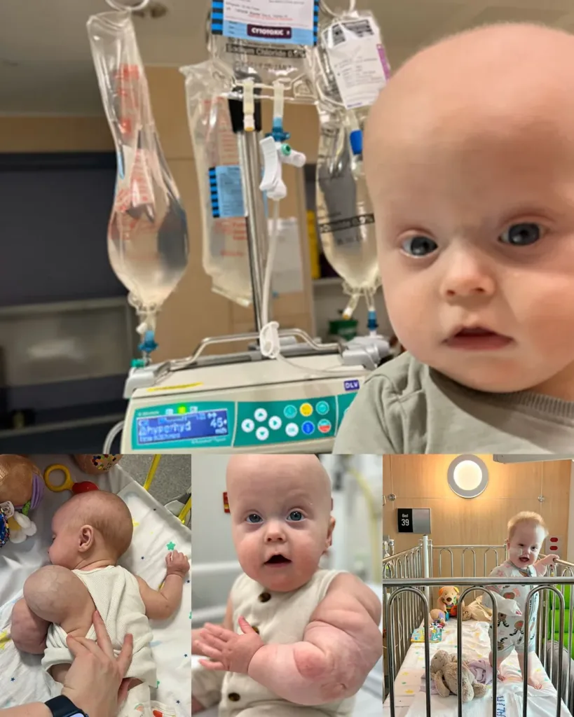 Toby’s Triumph: A Family’s Fight Against Infantile Cancer Toby’s Triumph: A Family’s Fight Against Infantile Cancer