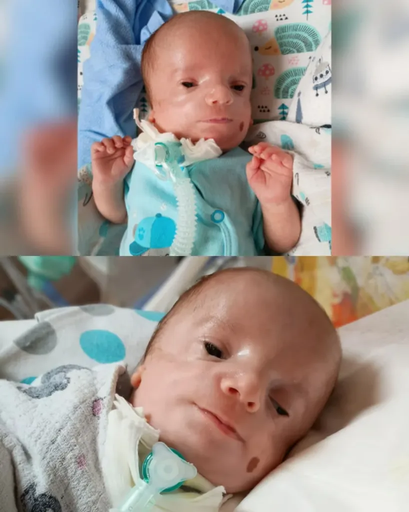 Wojtuś’s Delicate Battle – A Tale of Bravery Before His First Breath