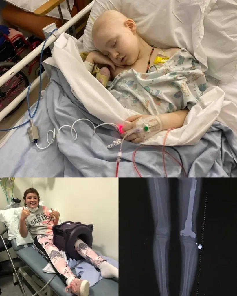 Yasmin’s Smile: The Little Fighter Who Faced Cancer with Courage Yasmin’s Smile: The Little Fighter Who Faced Cancer with Courage