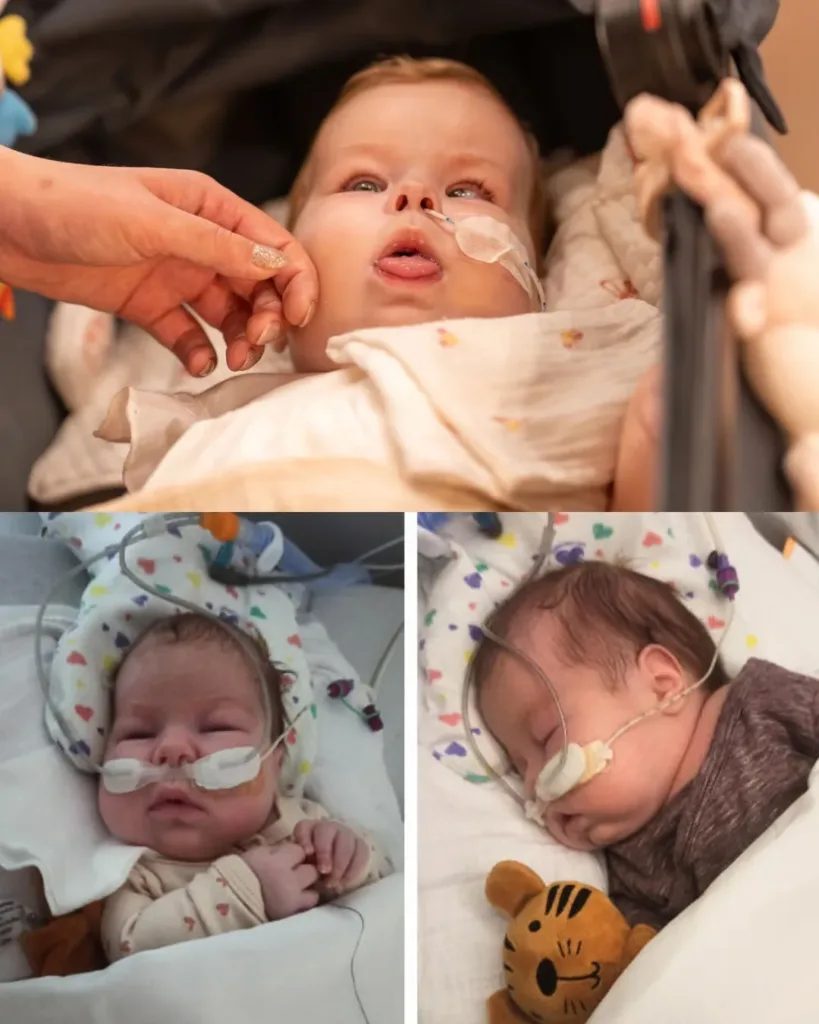 A Delicate Start: Baby Zosia’s Battle for Survival