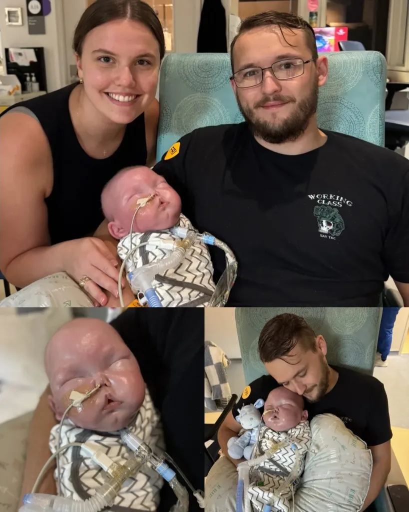 Theo’s Journey: Small Victories and Steady Healing (October 17–19 Update) Theo’s Journey: Small Victories and Steady Healing (October 17–19 Update)