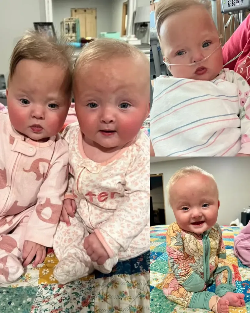 A Heartwarming Update on Zoey and Baylor Blythe: Miracles in the Making