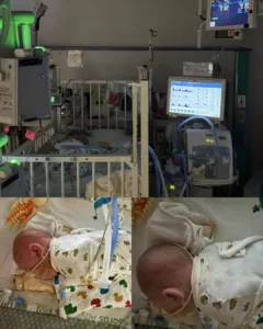 Theo’s Journey: Update from October 22nd – A Day Filled with Trials and Optimism Theo’s Journey: Update from October 22nd – A Day Filled with Trials and Optimism