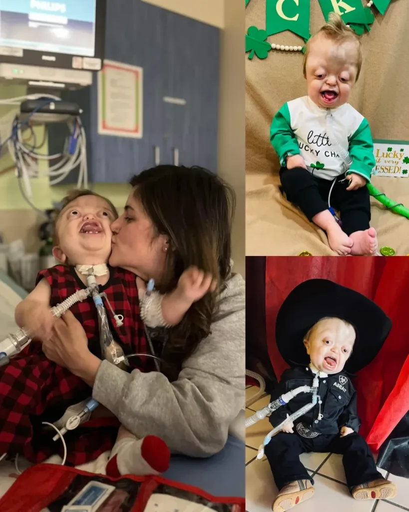 A Mother's Unwavering Love: Raedyn’s 20th Surgery and the Journey of Hope A Mother's Unwavering Love: Raedyn’s 20th Surgery and the Journey of Hope