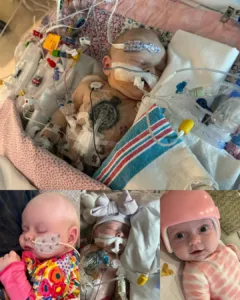 Sophie Kate: An Inspiring Heart Warrior